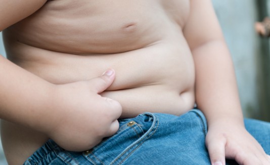 Obesidad infantil