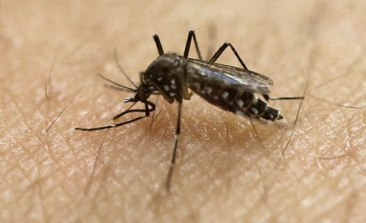 Muerte por microcefalia