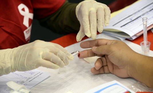 Prueba de VIH, SIDA