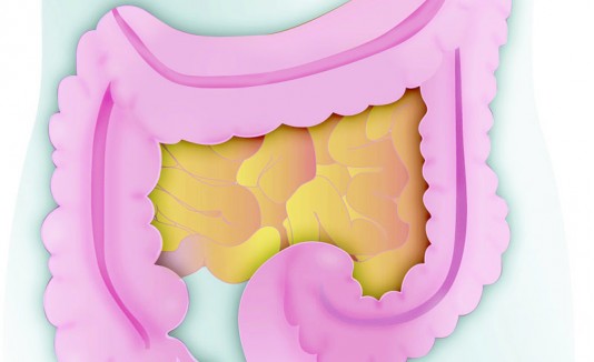 Cáncer de colon