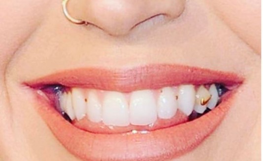 Katy Perry con quinoa en los dientes