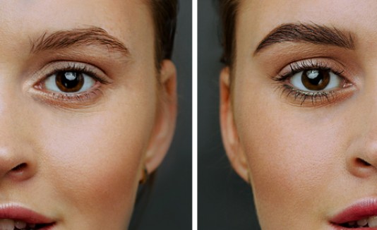 Cejas