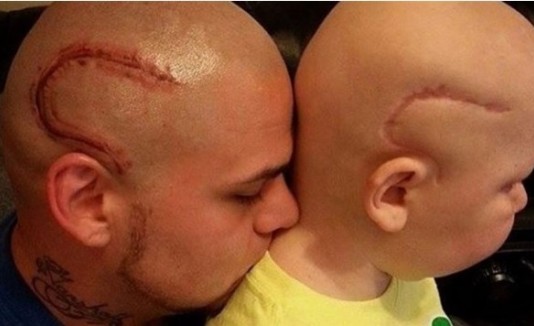 Niño con cáncer