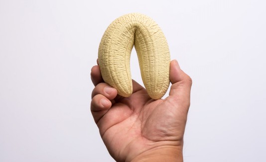 Disfunción eréctil del hombre de 37 años. Disfunción eréctil del hombre de 37 años.